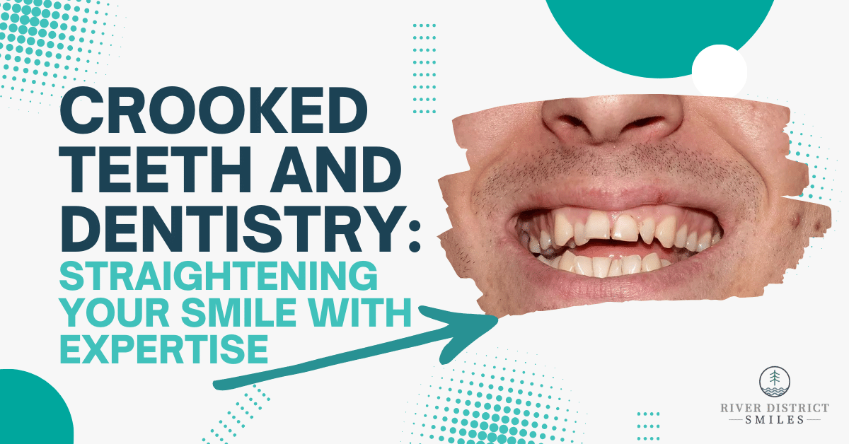 Crooked Teeth and Dentistry: Straightening Your Smile with Expertise