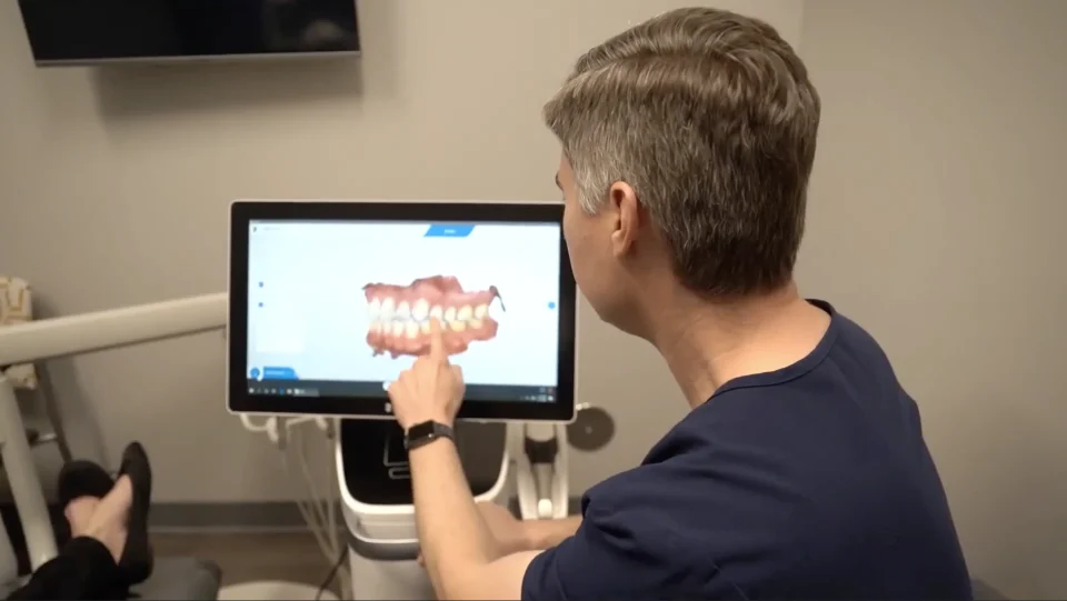 2 - Crowns & Bridges