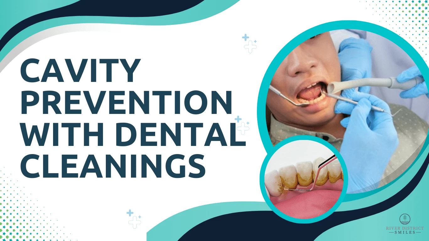 Cavity Prevention with Dental Cleanings
