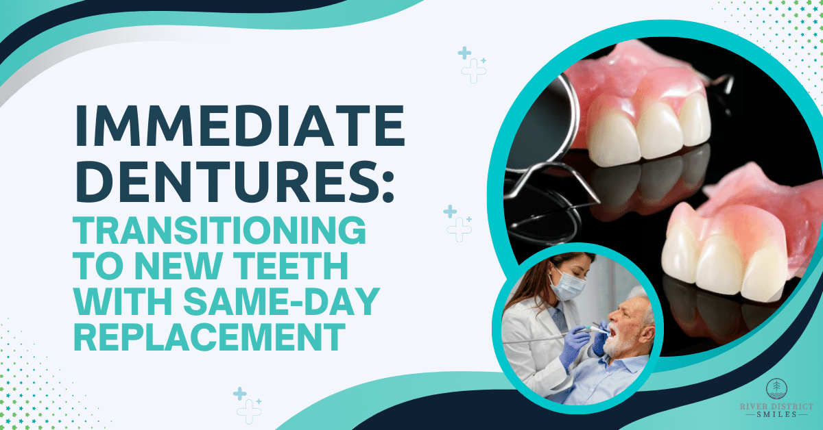 Immediate Dentures Transitioning to New Teeth with Same Day Replacement