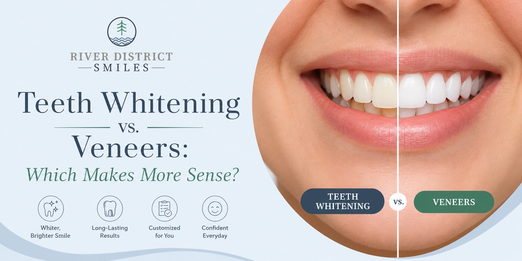 teeth whitenning vs veneers