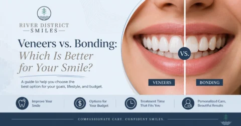 Veneers vs Bonding