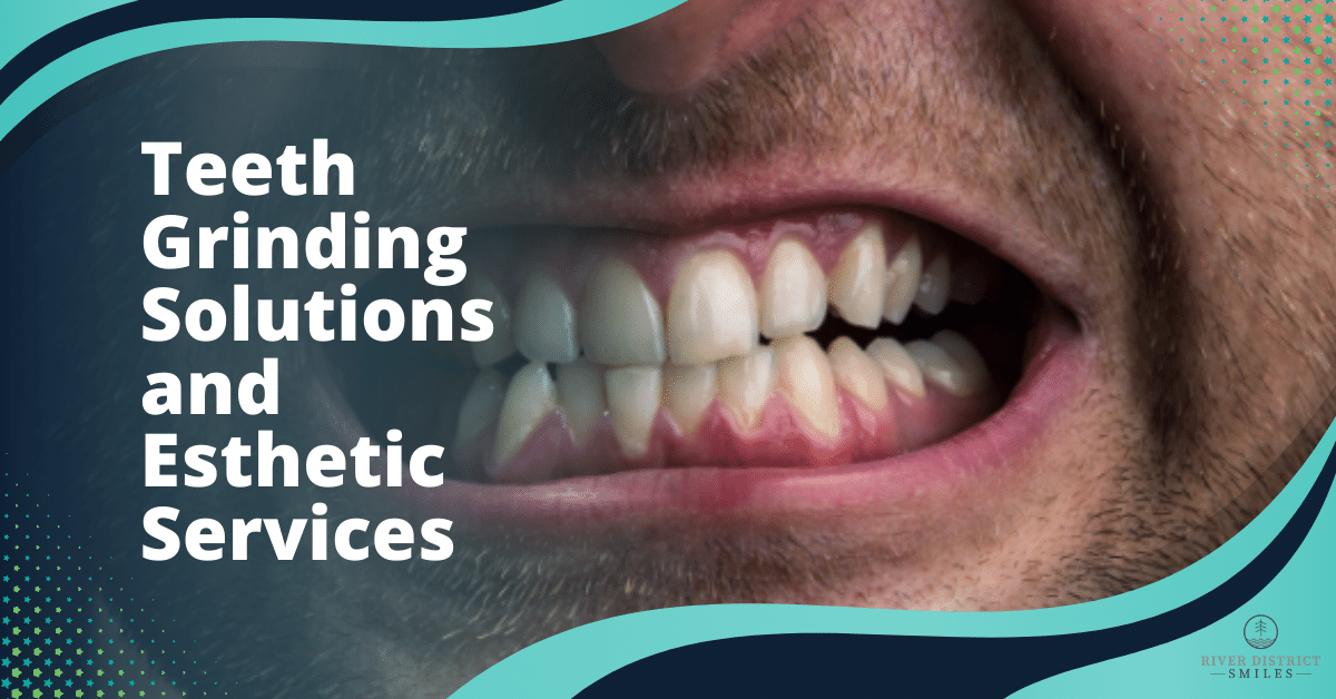 Teeth Grinding Solutions and Esthetic Services