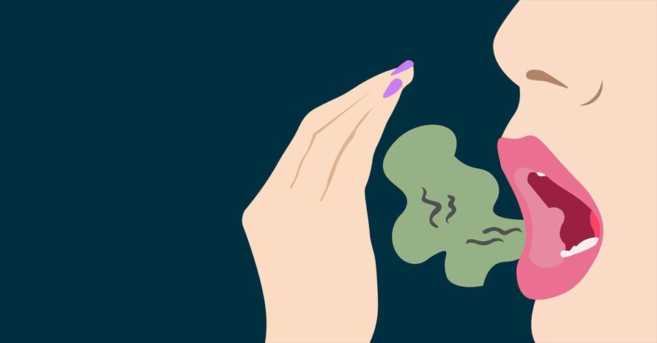 Fresh Breath Solutions: Bad Breath Remedies