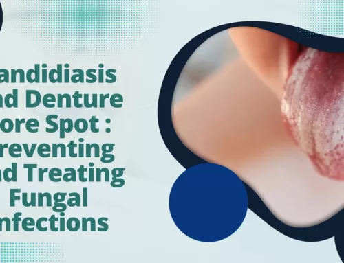 Candidiasis and Denture sore Spot : Preventing and Treating Fungal Infections