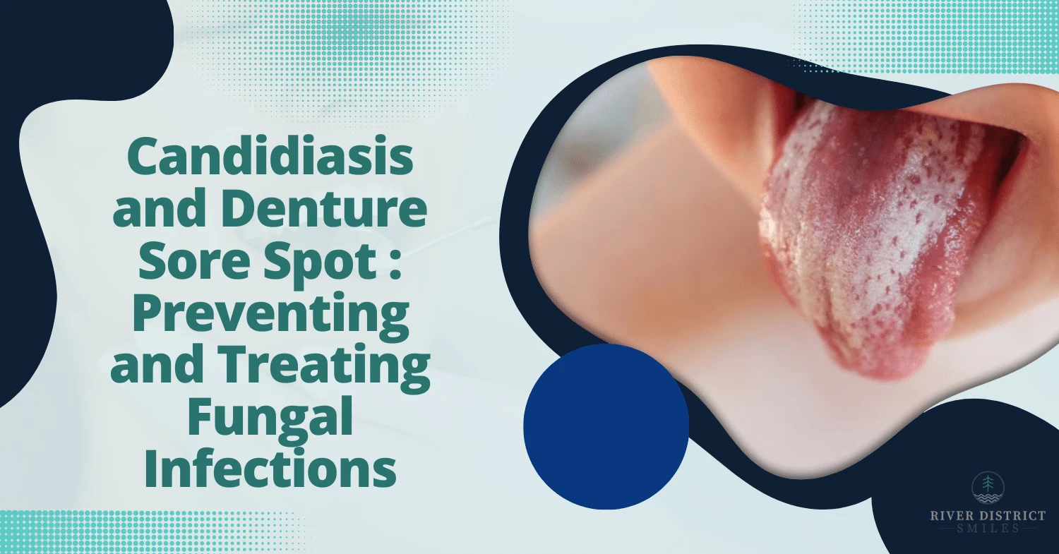 candidiasis and denture sore spot preventing and treating fungal infections
