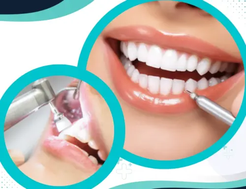 Dazzling Smiles Await: Rock Hill SC’s Best Dentist Exceptional Teeth Cleaning Services