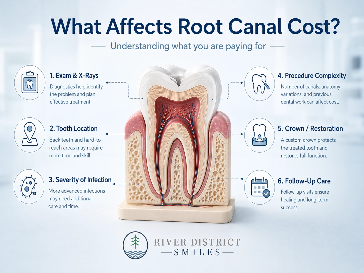 For Root Canal Cost