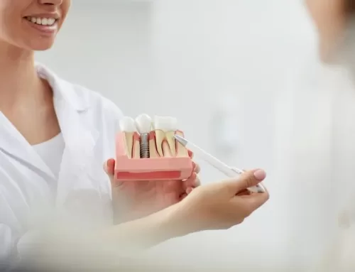 Do Gums Attach To Dental Implants?