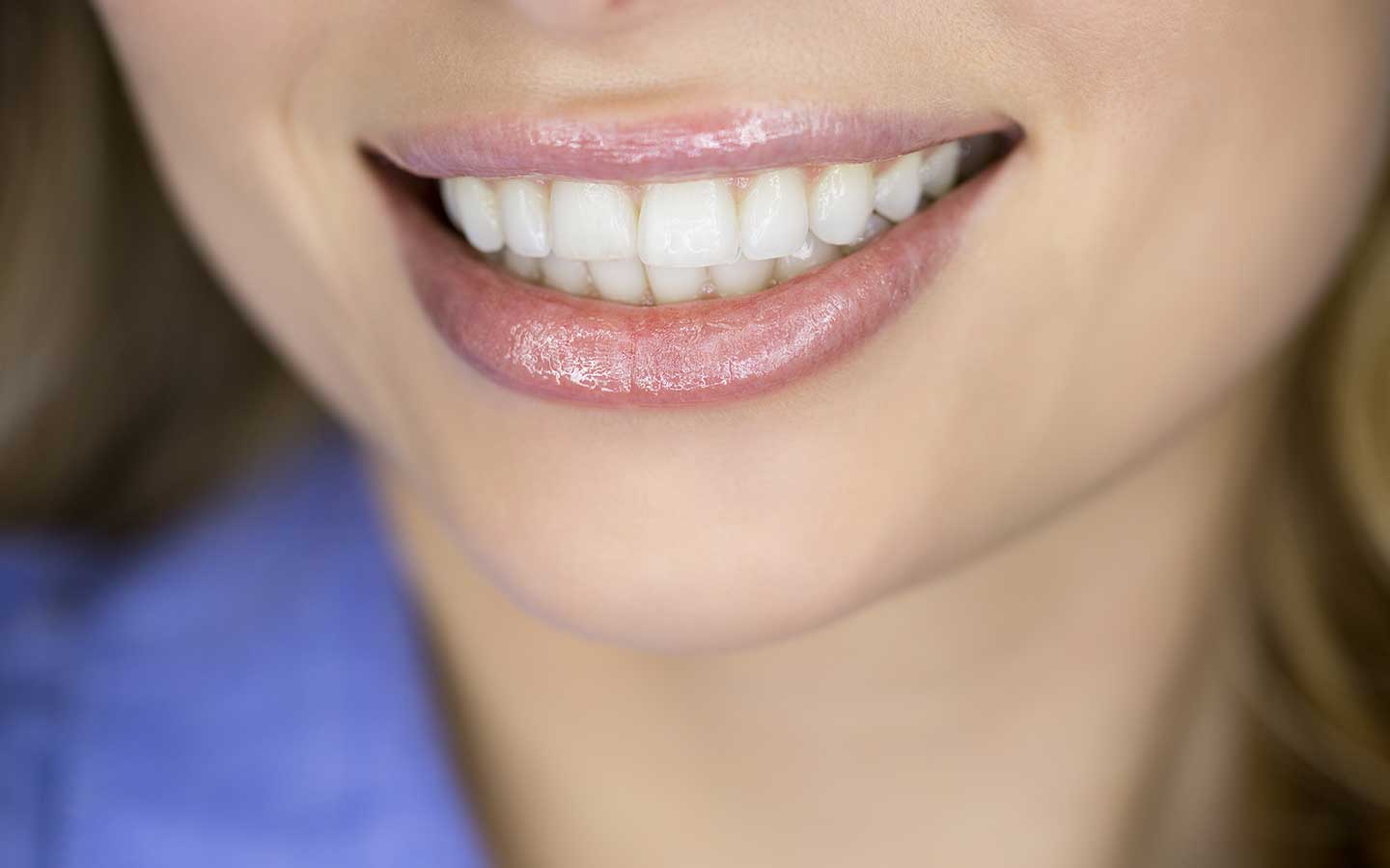 female-smiling-white-teeth