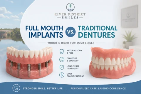Full Mouth Implants vs. Traditional Dentures