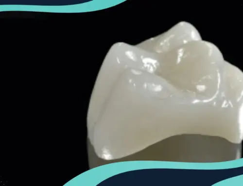 Rock Hill SC’s Dental Crowns: Exceptional Care for Perfect Smiles