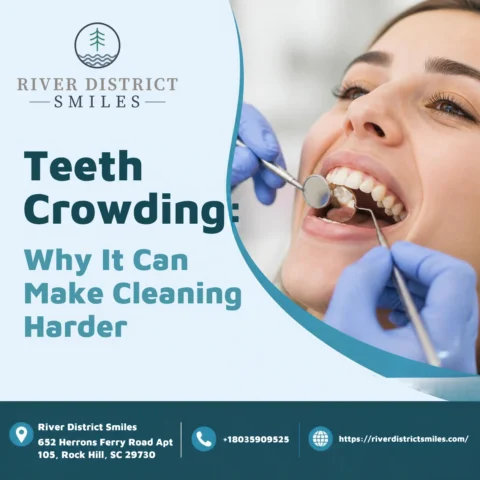 Teeth Crowding: Why It Can Make Cleaning Harder