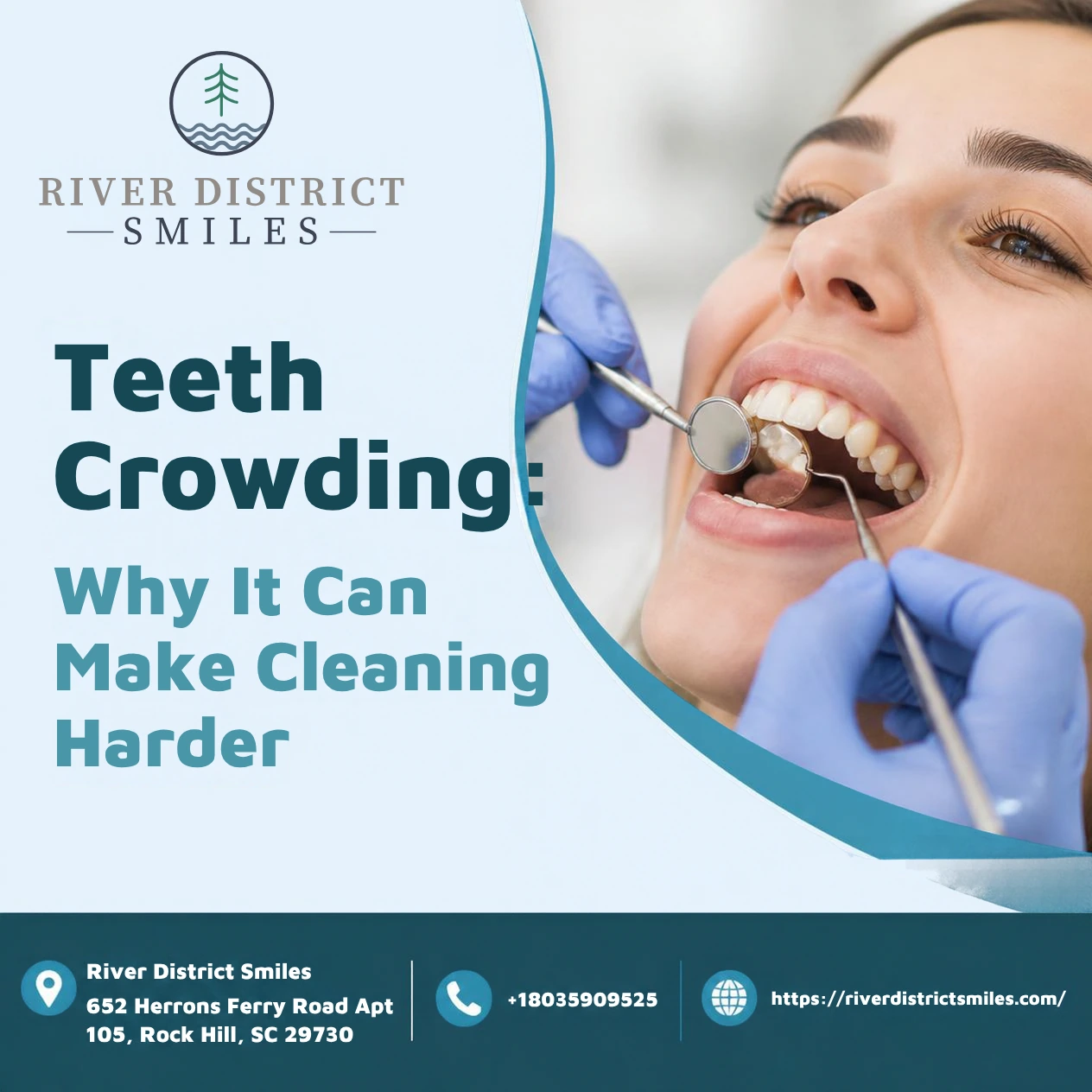 Teeth Crowding: Why It Can Make Cleaning Harder